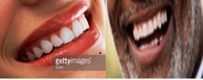 Ibyago byo kutagira amenyo y&rsquo;urwererane