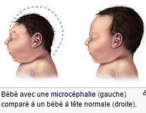 Virus ya Zika ije ari&nbsp;icyago