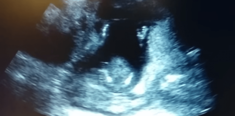 Ababyeyi bararirimbye, umwana mu nda akoma mu&nbsp;mashyi